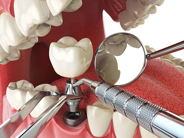 Best Emergency Root Canal Therapy in Dortches, NC